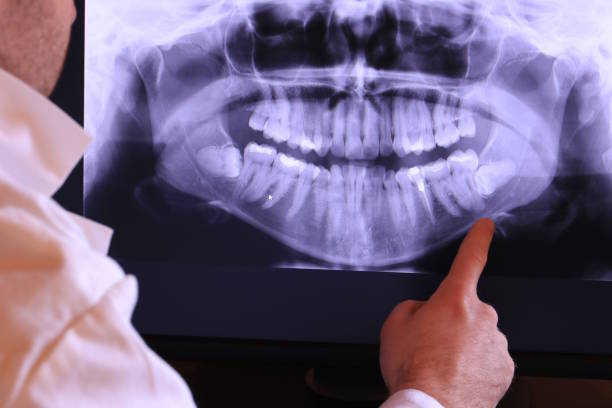 Best Emergency Dentist for Lost Fillings or Crowns in Chesterland, OH